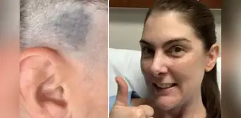 Fue a cortarse el cabello y su estilista notó algo que le salvó la vida: “Realmente me asustó” Fue a cortarse el cabello y su estilista notó algo que le salvó la vida: “Realmente me asustó”