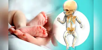 ¿Por qué los bebés al nacer tienen más huesos que los adultos? ¿Por qué los bebés al nacer tienen más huesos que los adultos?