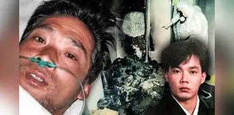 ¿Cómo fue el final de Hisashi Ouchi, el hombre que sufrió la mayor carga radioactiva de la historia?