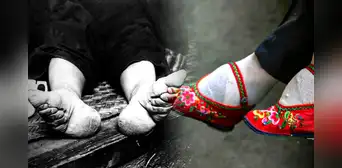 Pie de loto: ¿por qué las mujeres en China se vendaban los pies para deformarlos? Pie de loto: ¿por qué las mujeres en China se vendaban los pies para deformarlos?