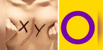 Día de la Conciencia para la Comunidad Intersexual: ¿por qué se celebra este 26 de octubre y cuál es su importancia?