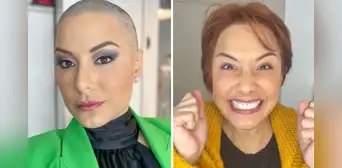 Natalia Salas muestra cicatriz tras operación de mastectomía y usuarios la elogian: “Eres guerrera e inspiración para muchas” Natalia Salas muestra cicatriz tras operación de mastectomía y usuarios la elogian: “Eres guerrera e inspiración para muchas”