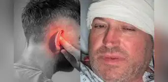 Pensó que sufría una infección de oído, pero tenía un tumor y le queda poco tiempo de vida Pensó que sufría una infección de oído, pero tenía un tumor y le queda poco tiempo de vida