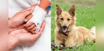 Niño de 1 año es atacado brutalmente por el perro de su niñera: madre pide ayuda para los gastos