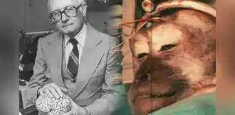 El experimento más cruel del doctor Robert White: trasplantó la cabeza de un mono a otro cuerpo