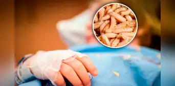 Niña de 4 años fue llevada al hospital y le extrajeron más de 100 gusanos de su cabeza Niña de 4 años fue llevada al hospital y le extrajeron más de 100 gusanos de su cabeza