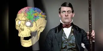 Phineas Gage: el hombre que vivió 12 años con un hueco en el cráneo por una varilla de metal