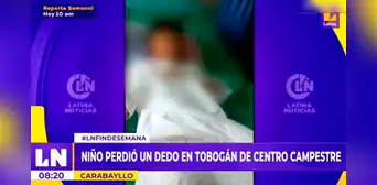Carabayllo: niño perdió un dedo mientras jugaba en un tobogán de centro campestre Carabayllo: niño perdió un dedo mientras jugaba en un tobogán de centro campestre