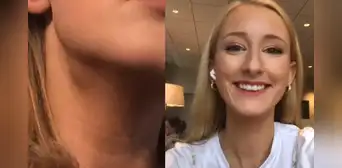 Joven descubre que tiene cáncer en etapa 4 después de realizar truco de belleza viral de TikTok Joven descubre que tiene cáncer en etapa 4 después de realizar truco de belleza viral de TikTok