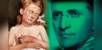 Joseph Goldberger, el doctor que comió heces de sus pacientes y nos salvó de una terrible epidemia Joseph Goldberger, el doctor que comió heces de sus pacientes y nos salvó de una terrible epidemia