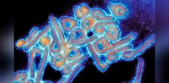 Guinea Ecuatorial declara alerta sanitaria tras confirmar 9 fallecidos por un virus similar al ébola Guinea Ecuatorial declara alerta sanitaria tras confirmar 9 fallecidos por un virus similar al ébola