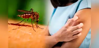 ¿Cómo quitar la picazón de un mosquito con remedios caseros? ¿Cómo quitar la picazón de un mosquito con remedios caseros?