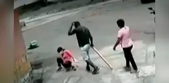 “Me pudo matar”: mujer fue golpeada por su vecino tras poner tranquera para impedir estacionamiento “Me pudo matar”: mujer fue golpeada por su vecino tras poner tranquera para impedir estacionamiento
