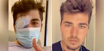 Joven durmió con los lentes de contacto puestos y un parásito se comió su ojo: Fue un dolor inexplicable