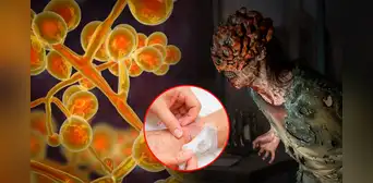 "The last of us": el hongo Cordyceps no es capaz de crear una epidemia, pero existe uno que sí "The last of us": el hongo Cordyceps no es capaz de crear una epidemia, pero existe uno que sí