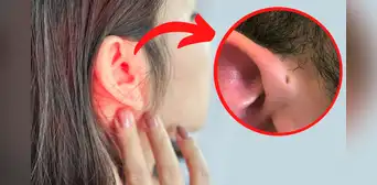 ¿Por qué algunas personas tienen un orificio en la oreja y otras no?