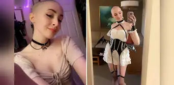 OnlyFans: joven usa ganancias para tratarse contra el cáncer y dice que sus fans "aman su look calvo" OnlyFans: joven usa ganancias para tratarse contra el cáncer y dice que sus fans "aman su look calvo"