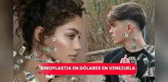 Rinoplastia en Venezuela: ¿cuánto cuesta una cirugía de nariz?