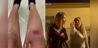 "Eres una 'Machu Picchu'. Tengo ojos azules”: españolas lanzan expresiones racistas contra pareja latina