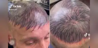 Hombre se tatúa la cabeza para disimular su calvicie y usuarios lo trolean: “Ya no se despeina” Hombre se tatúa la cabeza para disimular su calvicie y usuarios lo trolean: “Ya no se despeina”