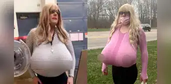 Suspenden a profesora por supuesta prótesis gigante de senos: alega tener gigantomastia Suspenden a profesora por supuesta prótesis gigante de senos: alega tener gigantomastia