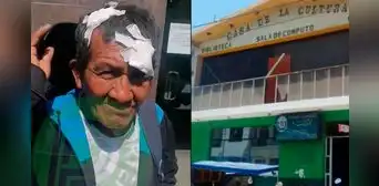 Anciano salva de morir tras ser atacado con fierros por delincuentes en Lambayeque Anciano salva de morir tras ser atacado con fierros por delincuentes en Lambayeque