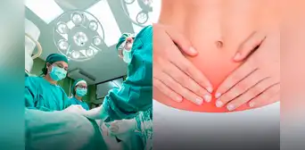 Extraen dildo de cristal de la vejiga de una mujer: se habría equivocado de orificio Extraen dildo de cristal de la vejiga de una mujer: se habría equivocado de orificio