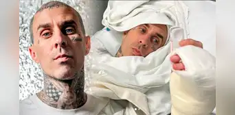 Travis Barker de Blink-182 tras cirugía en su dedo: "Fue un éxito, seguiré haciendo lo que me gusta" Travis Barker de Blink-182 tras cirugía en su dedo: "Fue un éxito, seguiré haciendo lo que me gusta"