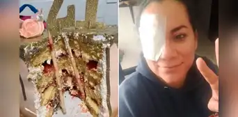 ¡Por poco se queda ciega! Hunden el rostro de mujer en pastel y termina con palo incrustado en el ojo ¡Por poco se queda ciega! Hunden el rostro de mujer en pastel y termina con palo incrustado en el ojo