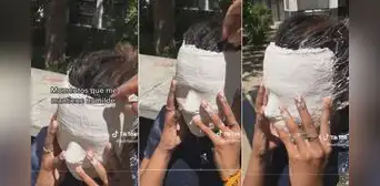 Joven queda con el yeso pegado a sus pestañas y se aterra al quitárselo