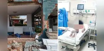 Adolescente de 15 años está en UCI y con quemaduras en el 63% de su cuerpo tras explosión en VES Adolescente de 15 años está en UCI y con quemaduras en el 63% de su cuerpo tras explosión en VES