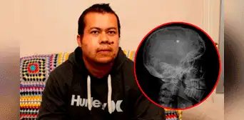 James Myers, el australiano que vive con 3 balas en la cabeza tras recibir 13 disparos en una casa James Myers, el australiano que vive con 3 balas en la cabeza tras recibir 13 disparos en una casa