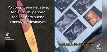 Joven pensó que sufría anemia, fue al doctor y se enteró de que tiene 5 meses de embarazo Joven pensó que sufría anemia, fue al doctor y se enteró de que tiene 5 meses de embarazo