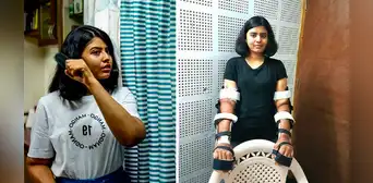 El increíble caso de la mujer que recibió un trasplante de brazos de un hombre y su cuerpo logró adaptarlos El increíble caso de la mujer que recibió un trasplante de brazos de un hombre y su cuerpo logró adaptarlos