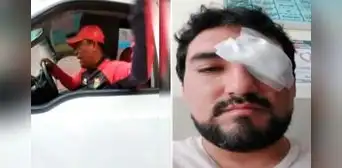Ate: hombre casi pierde la vista tras ser atacado por un entrenador de fútbol de menores