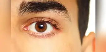¿Por qué late mi ojo y cuán peligroso es para mi salud? ¿Por qué late mi ojo y cuán peligroso es para mi salud?