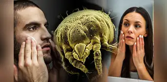 ¿Cómo son los ácaros que viven en nuestra cara? Ahí comen y se reproducen