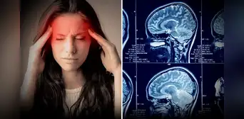Pensó que tenía un simple dolor de cabeza, pero va al hospital y le detectan un tumor cerebral Pensó que tenía un simple dolor de cabeza, pero va al hospital y le detectan un tumor cerebral