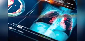 Crean tecnología que podría detectar cáncer en menos de 3 horas