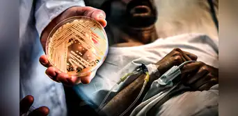 Candida auris: ¿por qué es considerado como "amenaza urgente" en Estados Unidos?