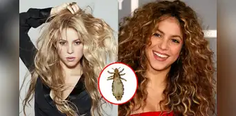 Shakira y la vez que reveló haber tenido piojos: ¿cuál fue la arriesgada forma para desaparecerlos? Shakira y la vez que reveló haber tenido piojos: ¿cuál fue la arriesgada forma para desaparecerlos?