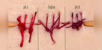 Inventan hilos de sutura que cambian de color al detectar heridas infectadas