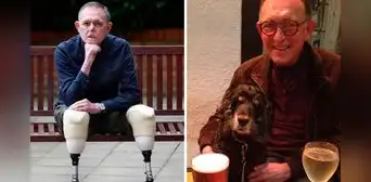 El terrible caso de Jaco: ¿cómo un arañazo de su perro le hizo perder sus piernas y parte de su cara? El terrible caso de Jaco: ¿cómo un arañazo de su perro le hizo perder sus piernas y parte de su cara?