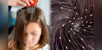 ¿Por qué algunos menores siempre tienen piojos, mientras que otros no, y cómo eliminarlos del cabello? ¿Por qué algunos menores siempre tienen piojos, mientras que otros no, y cómo eliminarlos del cabello?