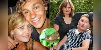Comió una babosa por un reto entre amigos, quedó tetrapléjico por años y luego murió