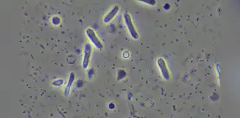 Nubes transportan bacterias resistentes a los antibióticos, según estudio