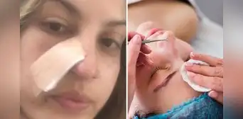 Joven se realiza una limpieza facial y descubre que tiene cáncer: "Mi mundo se derrumbó" Joven se realiza una limpieza facial y descubre que tiene cáncer: "Mi mundo se derrumbó"