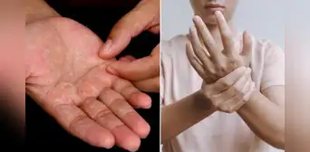 ¿Por qué se nos pelan las manos, cómo evitarlo y cuándo es peligroso?