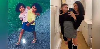 Así viven las hermanas siamesas que comparten pelvis y son sensación en TikTok
