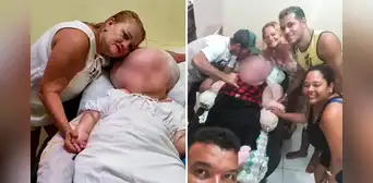Gaziely Alves: la joven brasileña con hidrocefalia gigante que lleva 29 años luchando por su vida Gaziely Alves: la joven brasileña con hidrocefalia gigante que lleva 29 años luchando por su vida